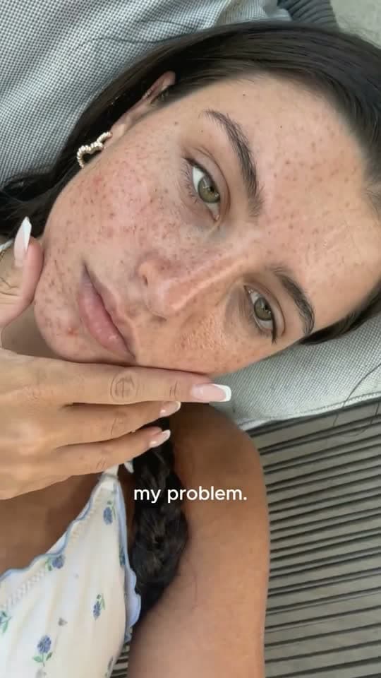 Vídeo UGC mostrando estrutura de problema e solução